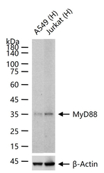 MyD88 Antibody in Western Blot (WB)