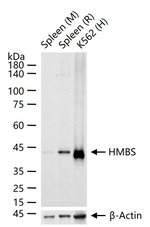HMBS Recombinant Rabbit Monoclonal Antibody (12C1)