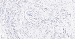 MAD2L1BP Antibody in Immunohistochemistry (Paraffin) (IHC (P))