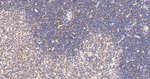 MAD2L1BP Antibody in Immunohistochemistry (Paraffin) (IHC (P))