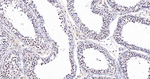 MAD2L1BP Antibody in Immunohistochemistry (Paraffin) (IHC (P))