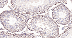 MAD2L1BP Antibody in Immunohistochemistry (Paraffin) (IHC (P))