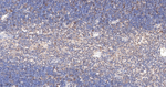 MAD2L1BP Antibody in Immunohistochemistry (Paraffin) (IHC (P))
