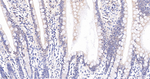 PYCARD Recombinant Rabbit Monoclonal Antibody (6C10)