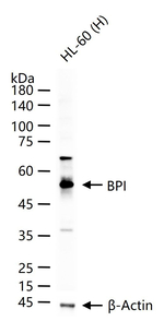 BPI Recombinant Rabbit Monoclonal Antibody (9D3)