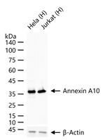 Annexin A10 Recombinant Rabbit Monoclonal Antibody (9B7)