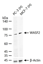 WAVE2 Recombinant Rabbit Monoclonal Antibody (1E12)