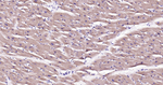 SMAC Antibody in Immunohistochemistry (Paraffin) (IHC (P))