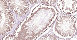 SMAC Antibody in Immunohistochemistry (Paraffin) (IHC (P))