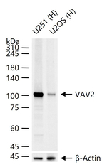 VAV2 Antibody in Western Blot (WB)