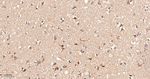 COX1 Antibody in Immunohistochemistry (Paraffin) (IHC (P))