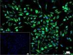 DKK1 Recombinant Rabbit Monoclonal Antibody (5D6)