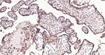 DKK1 Antibody in Immunohistochemistry (Paraffin) (IHC (P))