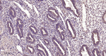 DKK1 Antibody in Immunohistochemistry (Paraffin) (IHC (P))