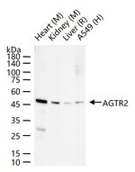 AGTR2 Recombinant Rabbit Monoclonal Antibody (4F6)