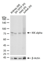 IKK alpha Recombinant Rabbit Monoclonal Antibody (18F3)