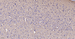 BIN1 Antibody in Immunohistochemistry (Paraffin) (IHC (P))