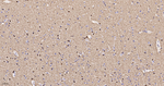 BIN1 Antibody in Immunohistochemistry (Paraffin) (IHC (P))