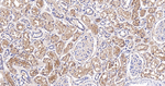 BIN1 Antibody in Immunohistochemistry (Paraffin) (IHC (P))