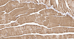 BIN1 Recombinant Rabbit Monoclonal Antibody (8H4)