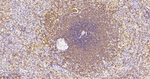 BIN1 Antibody in Immunohistochemistry (Paraffin) (IHC (P))