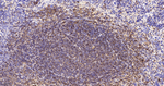 BIN1 Antibody in Immunohistochemistry (Paraffin) (IHC (P))