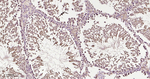 DJ-1 Antibody in Immunohistochemistry (Paraffin) (IHC (P))