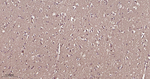 DJ-1 Antibody in Immunohistochemistry (Paraffin) (IHC (P))