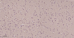 DJ-1 Antibody in Immunohistochemistry (Paraffin) (IHC (P))