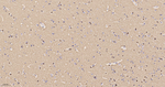 BIN1 Recombinant Rabbit Monoclonal Antibody (1A3)
