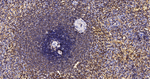 BIN1 Antibody in Immunohistochemistry (Paraffin) (IHC (P))