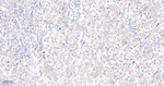 TNFAIP3 Antibody in Immunohistochemistry (Paraffin) (IHC (P))