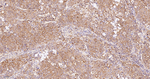 PKM2 Antibody in Immunohistochemistry (Paraffin) (IHC (P))