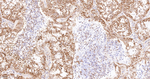 PKM2 Recombinant Rabbit Monoclonal Antibody (9H2)