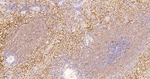 PKM2 Antibody in Immunohistochemistry (Paraffin) (IHC (P))
