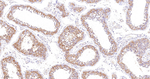 PKM2 Antibody in Immunohistochemistry (Paraffin) (IHC (P))