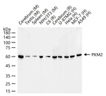 PKM2 Antibody in Western Blot (WB)