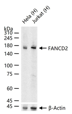 FANCD2 Recombinant Rabbit Monoclonal Antibody (17C6)