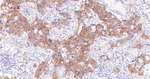 INPP4B Antibody in Immunohistochemistry (Paraffin) (IHC (P))