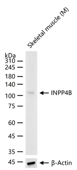 INPP4B Antibody in Western Blot (WB)