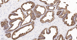 PSA Recombinant Rabbit Monoclonal Antibody (11G7)