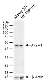 AP2M1 Recombinant Rabbit Monoclonal Antibody (10G14)