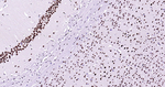 BRG1 Antibody in Immunohistochemistry (Paraffin) (IHC (P))