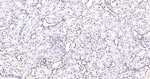 BRG1 Antibody in Immunohistochemistry (Paraffin) (IHC (P))