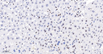BRG1 Antibody in Immunohistochemistry (Paraffin) (IHC (P))