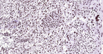 BRG1 Antibody in Immunohistochemistry (Paraffin) (IHC (P))
