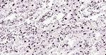 BRG1 Antibody in Immunohistochemistry (Paraffin) (IHC (P))