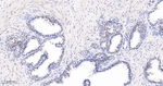 BRG1 Antibody in Immunohistochemistry (Paraffin) (IHC (P))