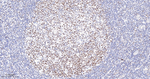 BRG1 Antibody in Immunohistochemistry (Paraffin) (IHC (P))