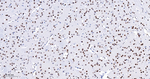 BRG1 Antibody in Immunohistochemistry (Paraffin) (IHC (P))